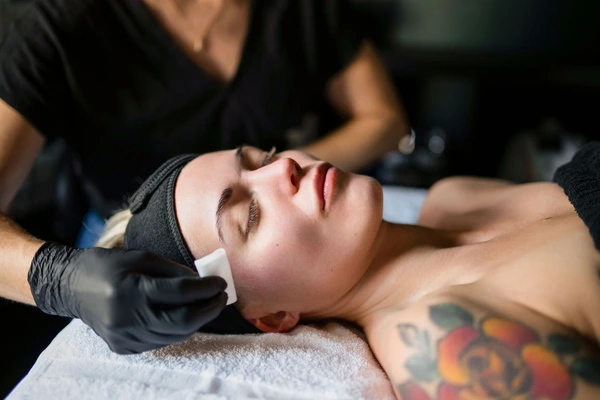 Chemical Peels